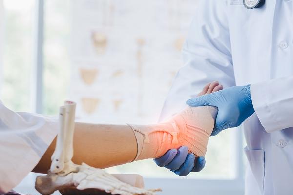 Causing Pain in the Feet