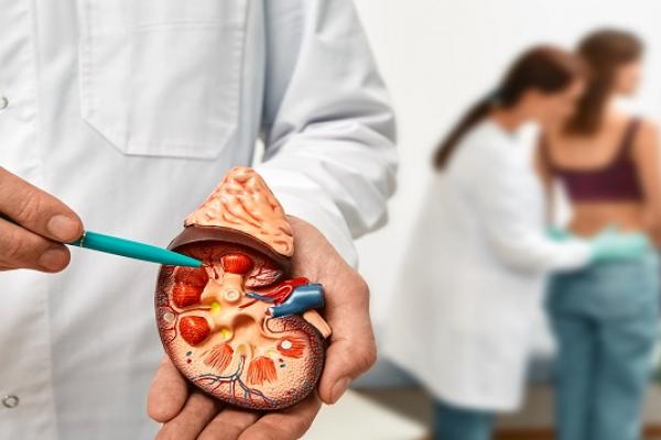 6 Misconceptions About Kidney Stones