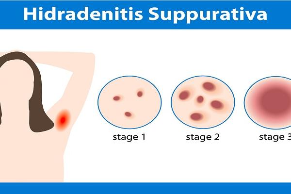There Are Satisfactory Results in The Treatment of Canine Mammary Disease