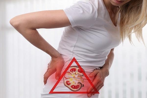 Although kidney stones, which seriously affect the quality of life, are mostly seen in men, a recent study revealed that the percentage of stone incidence in women has also increased. Urology Specialist Assoc. Prof. Dr. İlter Alkan evaluated the reasons underlying the increase in the rate of kidney stones in women according to the 'Gender Differences in Urinary Tract Stones' research conducted in America in 2021... Reminding that kidney stones are one of the most common problems of urology, Urology Speciali