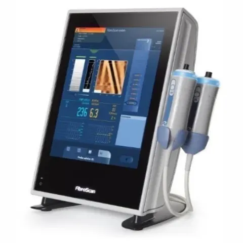 fibro_scan