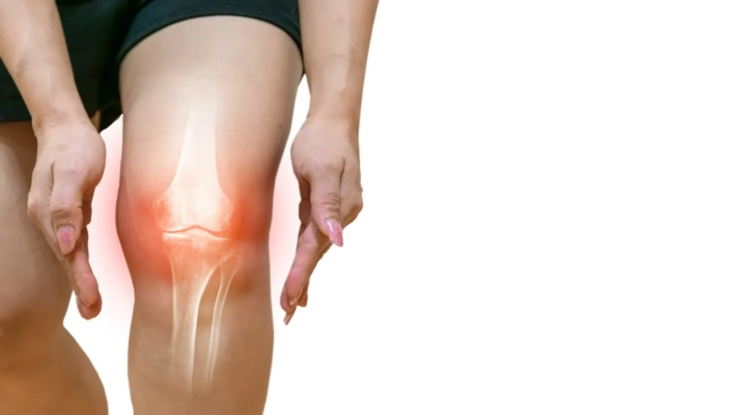  Treatment of cartilage problems